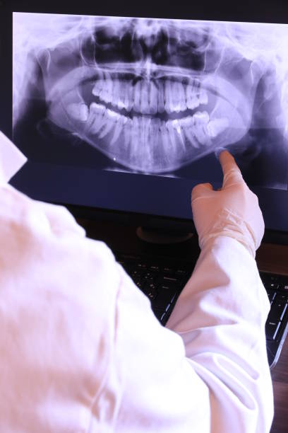 Best Emergency Tooth Extraction in Montara, CA