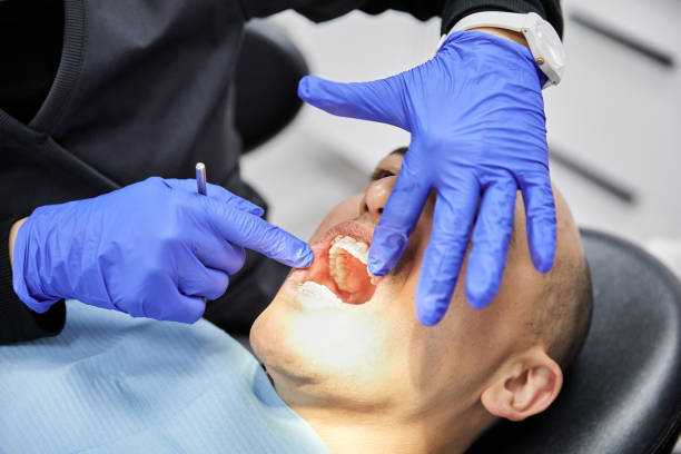 Best Emergency Denture Repair in Montara, CA
